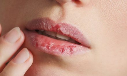 Kondisi Mulut Yang Kasar Ini Mempunyai Dampak Buruk