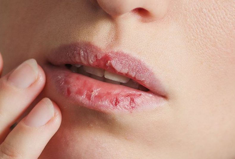 Kondisi Mulut Yang Kasar Ini Mempunyai Dampak Buruk