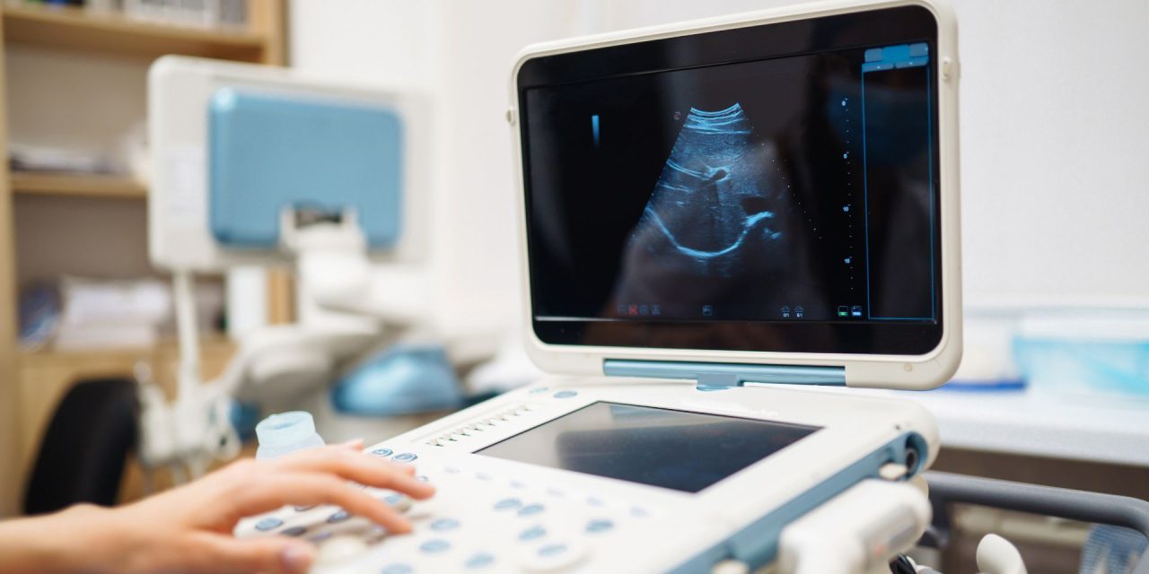 Perangkat Medis Ultrasonografi Atau Alat USG Yang Canggih