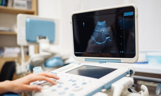 Perangkat Medis Ultrasonografi Atau Alat USG Yang Canggih