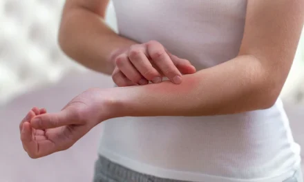 Reaksi Tubuh Terhadap Zat Tertentu Membuat Alergi