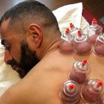 Pengobatan Tradisional Bekam Yang Masih Banyak Tersedia