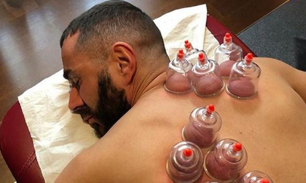 Pengobatan Tradisional Bekam Yang Masih Banyak Tersedia