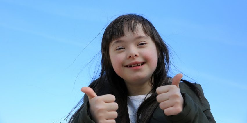 Kondisi Dari Genetik Seseorang Mengalami Down Syndrome